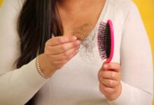 Effective Postpartum Hair Loss Remedies