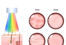 LED Light Therapy London: The Dermalux Tri-Wave MD Guide (Marylebone)