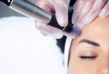 Mesotherapy in Dubai The Popular Skin Boost Redefining Modern Beauty