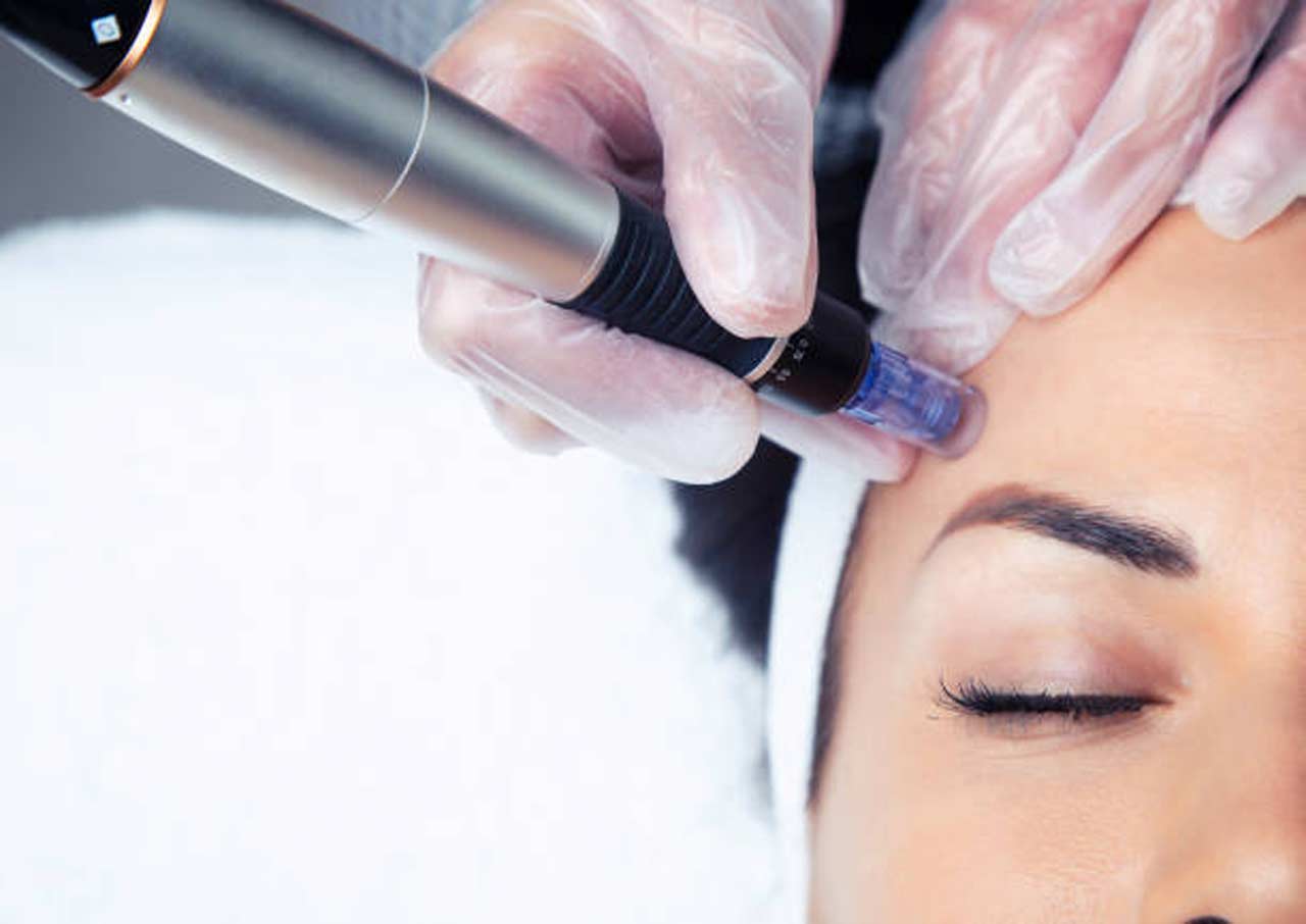 Mesotherapy in Dubai The Popular Skin Boost Redefining Modern Beauty