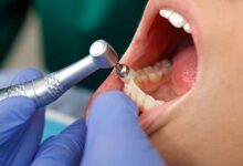 Is It a Dental Emergency