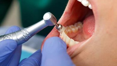 Is It a Dental Emergency