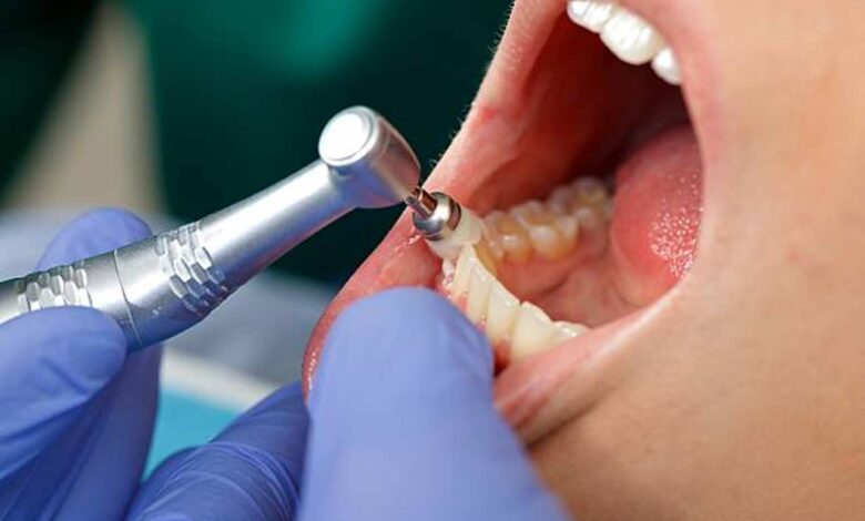 Is It a Dental Emergency