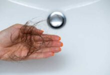 Trichotillomania and Hair-Pulling Disorder vs Stress-Induced Hair Loss: Which Condition Requires Professional Treatment?