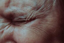 The Science of Skin Aging: What Actually Slows It Down